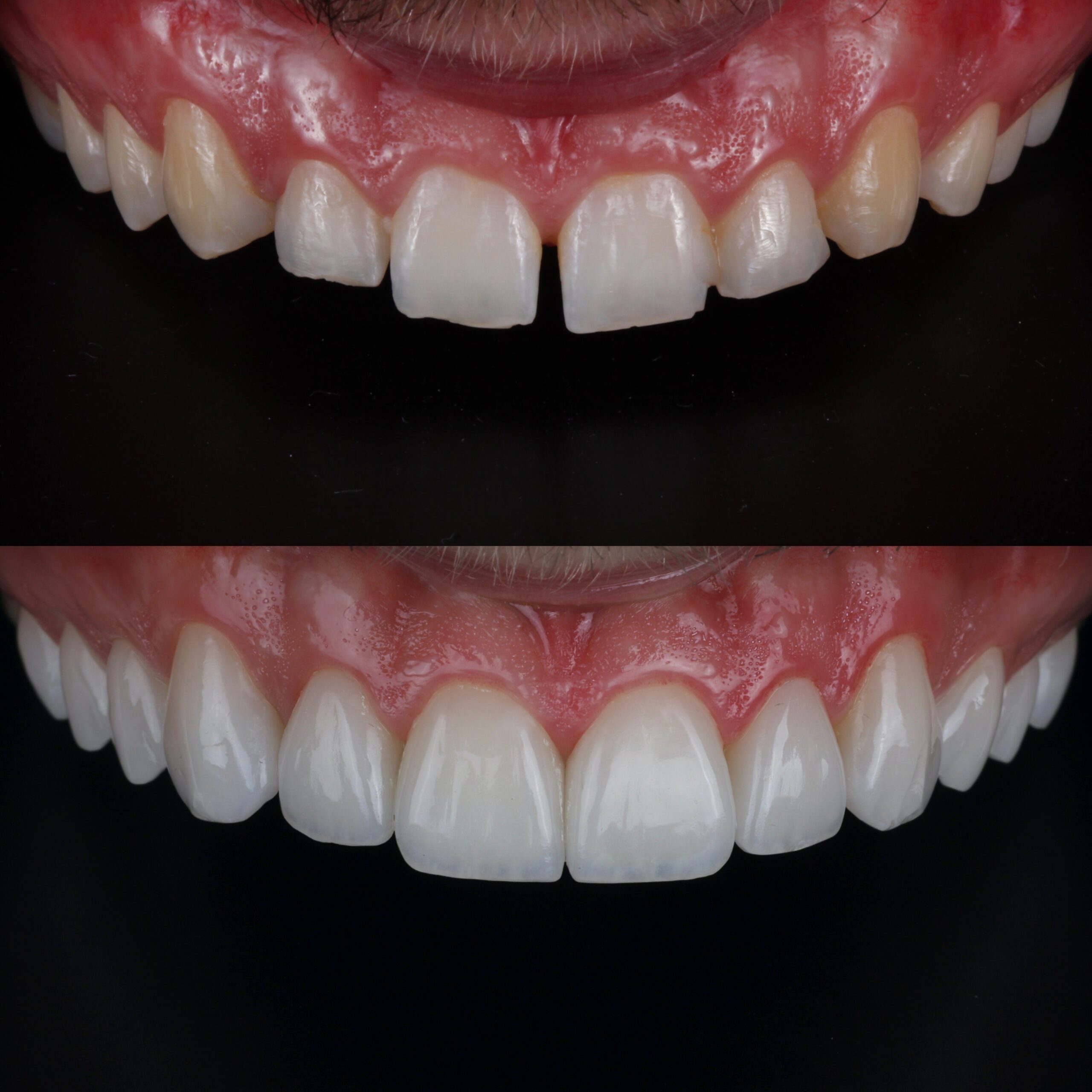 Copia-de-317F0E97-748F-4B2F-AEF9-A9D3B81726CE-scaled.jpeg